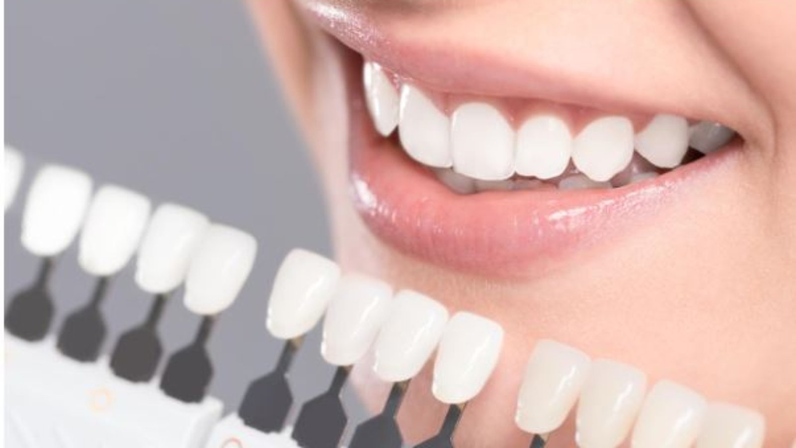 Reasons Why Cosmetic Dentistry Can Boost Your Confidence